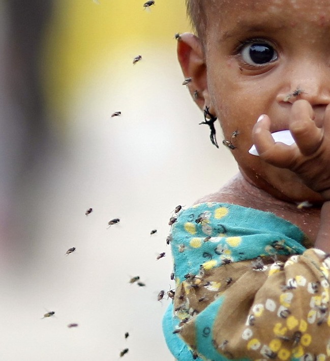 圖片：一名生病小女孩被蒼蠅環繞